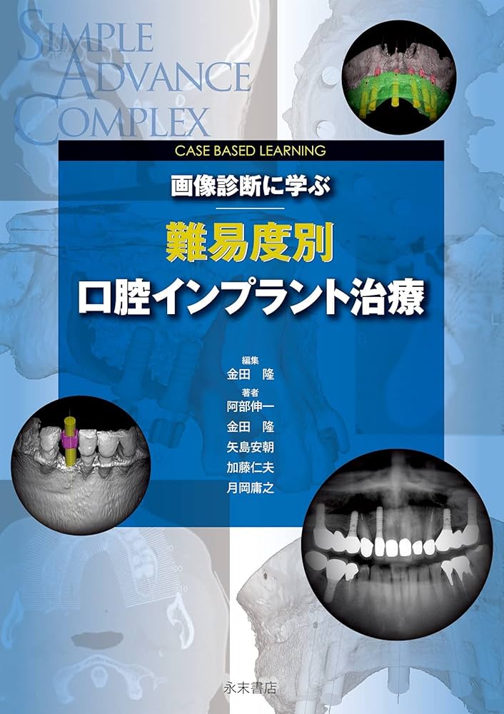 Case Based Learning 画像診断に学ぶ 難易度別口腔インプラント